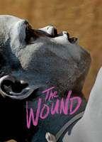The Wound Butt Gay 8568