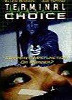 Terminal Choice 90534