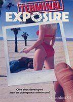 Terminal Exposure Breasts Butt 91075