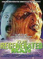 The Regenerated Man Breasts* 92054