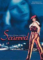 Scarred Breasts* 89648