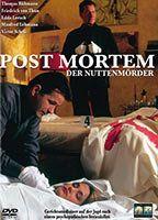 Post Mortem Breasts Butt 88091