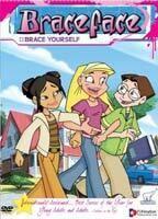 Braceface 71833