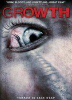 Growth Breasts Right Breast 73362