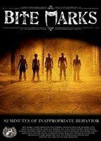 Bite Marks Breasts Right Breast 117876