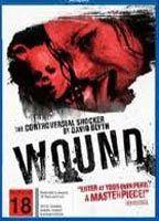 Wound Breasts Butt 73944