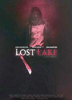 Lost Lake Butt Right Breast 91040