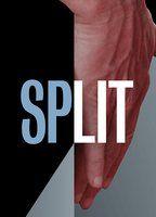 Split Breasts Bush 109588