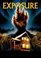 Exposure Breasts Right Breast 113197