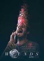 Wounds Breasts Butt 115200