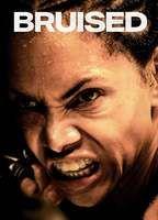 Bruised Bikini Breasts 129564