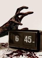 6:45 Breasts Left Breast 130776